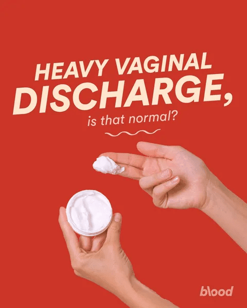 Heavy Vaginal Discharge