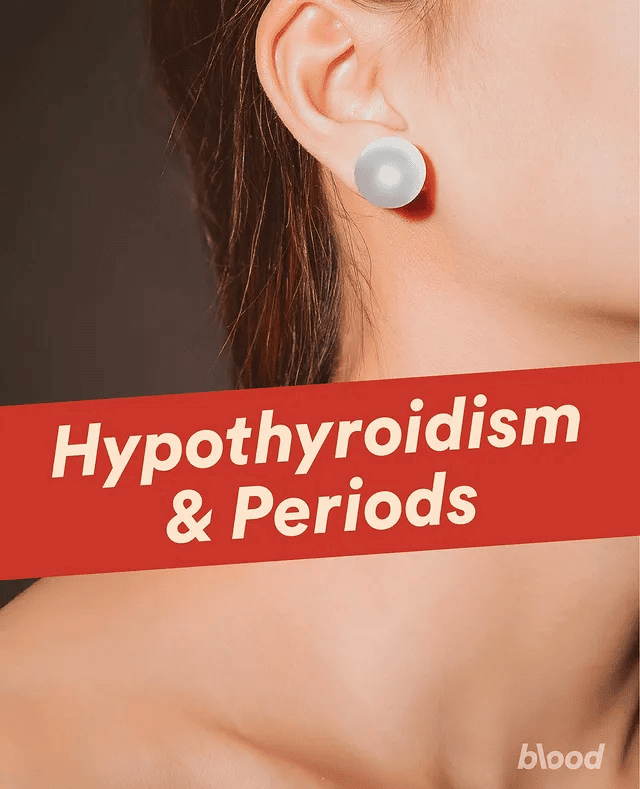 Hypothyriodism and period