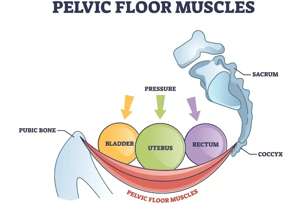 Stages of Uterine Prolapse. Pelvic Floor Muscles Weakening