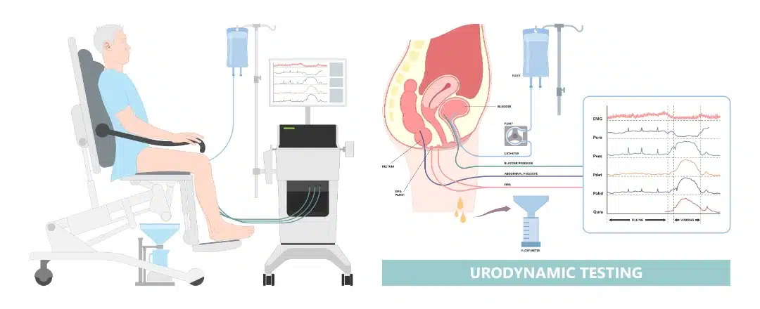 urodynamic testing