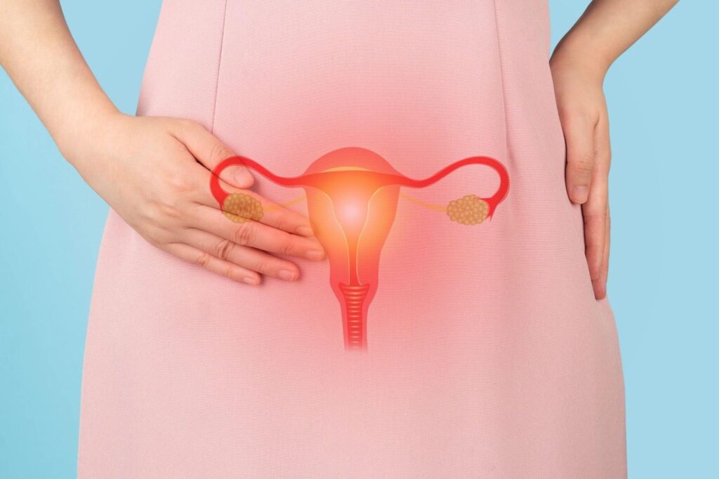 Findings of ovarian cysts and specialist review in Singapore